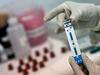Lani odkritih 55 primerov okužb z virusom HIV