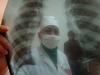 Evropi grozi epidemija tuberkuloze