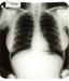 Marilynini rentgenski posnetki, Elvisova srajca - spominki za vrtoglave zneske