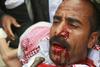 Saleh za pokol obdolžil protestnike, razglasil izredne razmere