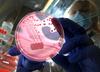 Prve žrtve nevarne bakterije v Nemčiji