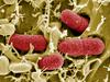 Ameriški znanstveniki: Antibiotiki niso rešitev za E. coli