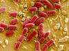V Nemčiji še dve žrtvi bakterije, okužbe tudi v Avstriji