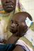 Klici na pomoč iz Nigra: vse več otrok resno podhranjenih