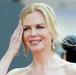 Nicole Kidman priznala uporabo botoksa: Končno lahko premikam obraz