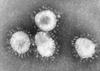 V Savdski Arabiji odkrili nove primere koronavirusa