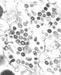 V Franciji prva smrtna žrtev zaradi novega koronavirusa