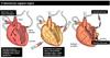 Tkivno inženirstvo: Kako vzgojiti srce v laboratoriju?