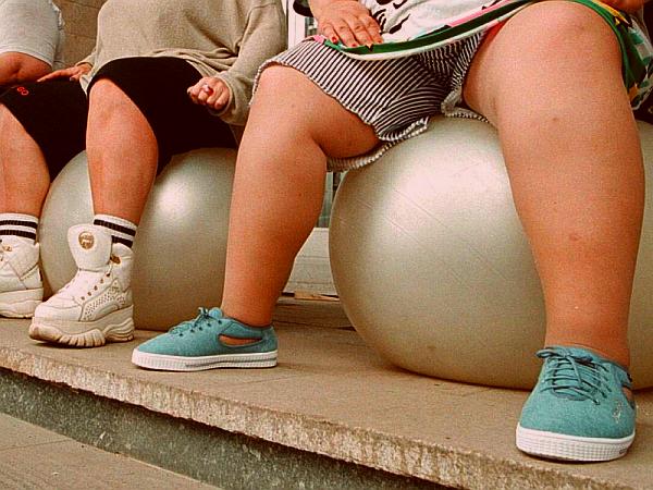 Skorajda ni države v razvitem svetu, ki se ne bi ubadala s problemom debelosti. Foto: BoBo