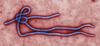 Moški v Savdski Arabiji bi lahko bil prva žrtev ebole zunaj Afrike