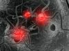 Znanstveniki dosegli nov preboj v boju s parkinsonovo boleznijo