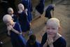 Tanzanija: Obredni uboji otrok albinov se nadaljujejo
