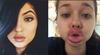 Nov (boleči) izziv najstnic: kako priti do ustnic, kot jih ima Kardashianka