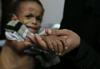 ZN opozarjajo na lakoto, ki letos grozi Jemnu