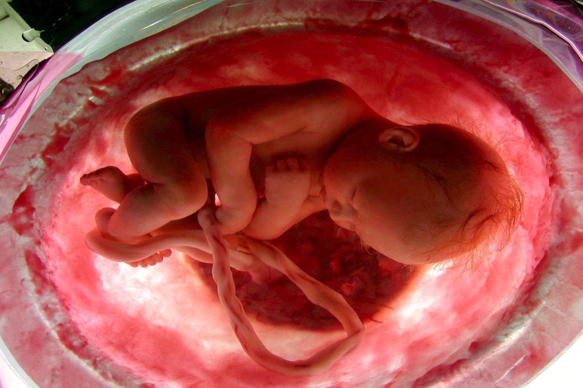 Umetna maternica bi bila lahko v prihodnosti primerna tudi za človeške nedonošenčke okoli 23. tedna. Foto: EPA