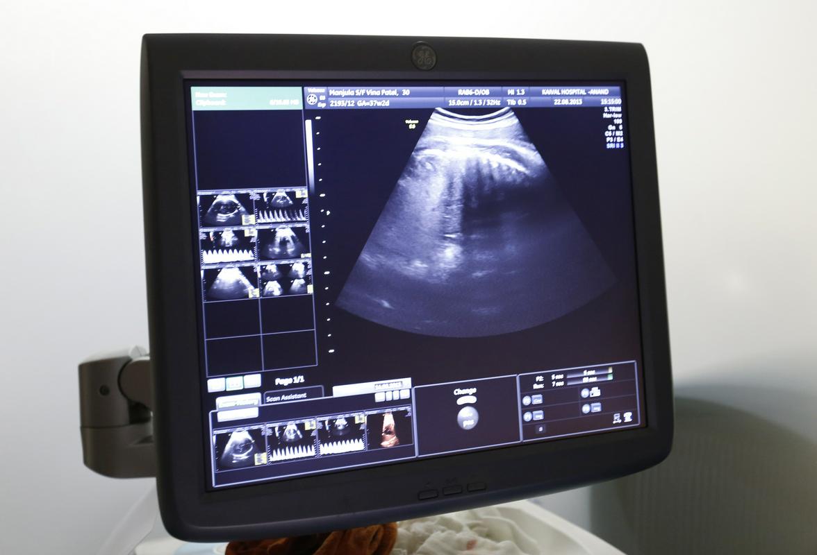 Nacionalni center za donacije zarodkov je posredoval pri rojstvu 1260 otrok. Foto: Reuters