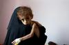 ZN: V Jemnu lakota grozi 14 milijonom ljudi