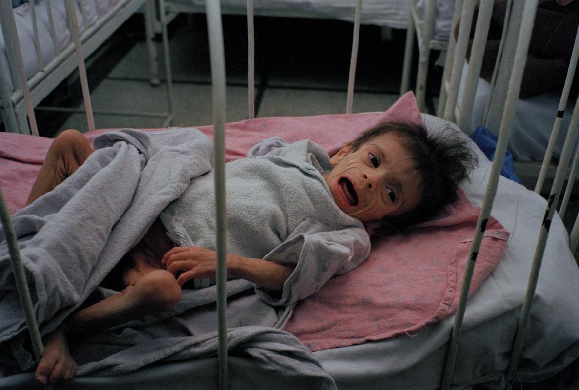Fotografija je nastala leta 1990 v bolnišnici v Bukarešti. Številni otroci iz tega obdobja so bili okuženi z AIDS-om. Foto: AP