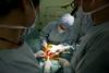 Slovenija z Eurotransplantom letno izmenja do 60 organov