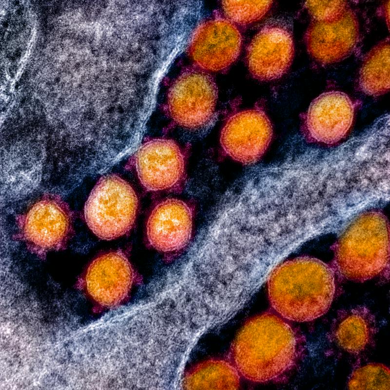 Tako je videti koronavirus pod mikroskopom. Foto: EPA