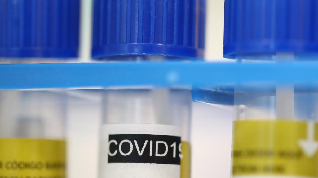 Po svetu potekajo številna testiranja za zdravilo proti novemu koronavirusu. Foto: Reuters