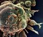 Novi koronavirus pri tretjini povzroča nevrološke težave, kot sta vrtoglavica in glavobol