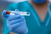 Novembra najvišje število umrlih v 20 letih. Cepivo v Slovenijo prihaja 26. decembra.