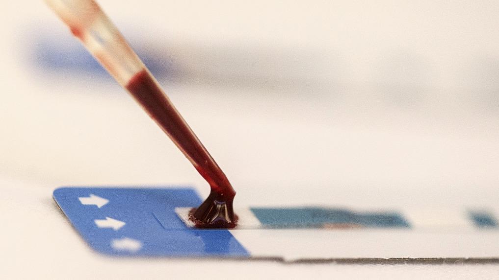 Krvni test za odkrivanje več kot 50 vrst raka je bil v raziskavi natančen v 62 odstotkih primerov