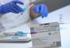 AstraZeneca znova zamuja pri dobavi, Madžarska začenja cepljenje s kitajskim cepivom