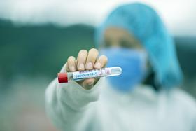 V nedeljo potrjenih 477 okužb z novim koronavirusom, umrlo pet covidnih bolnikov