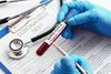 V nedeljo potrdili 727 primerov okužbe z novim koronavirusom