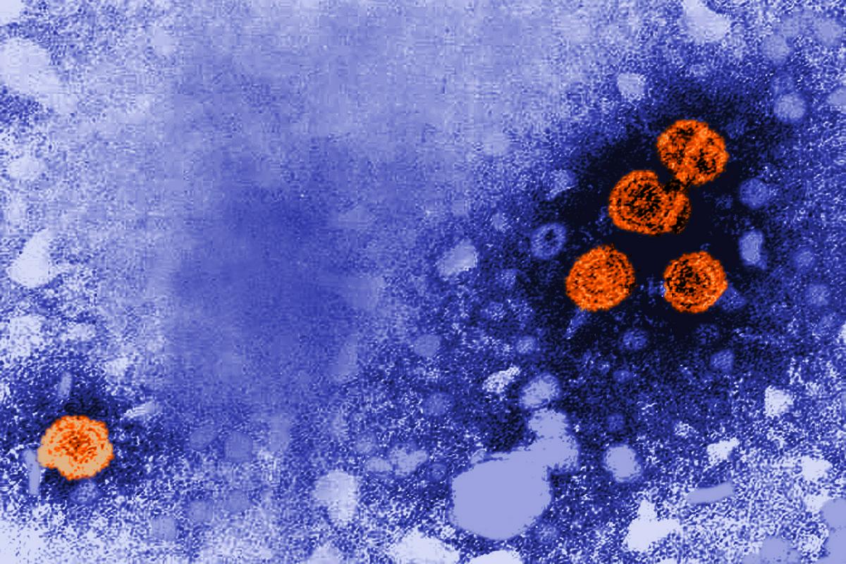 Virus hepatitisa pod mikroskopom. Foto: AP