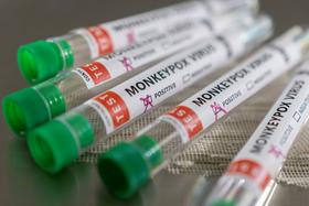 V Sloveniji potrdili drugi primer okužbe z virusom opičjih koz