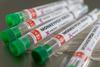 Slovenija bo od Evrope prejela 1400 odmerkov cepiva proti opičjim kozam