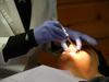 Ministrstvo za zdravje napoveduje skrajševanje čakalnih dob pri ortodontih
