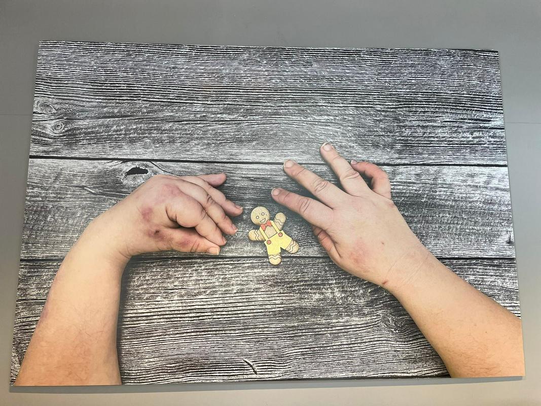 Na sliki je ena od razstavljenih fotografij. Na njej sta roki osebe s cerebralno paralizo, leva je značilno zakrčena proti desni, desna dlan pa je iztegnjena. Roki sta rahlo obrnjeni druga proti drugi. Vmes je lesen piškot v obliki možička, ki ima rdeč metuljček in rumene hlače z naramnicami, ki imajo rdeča gumba na levi in desni strani pasu. Foto: MMC RTV SLO/Ana Vojnović Zorman