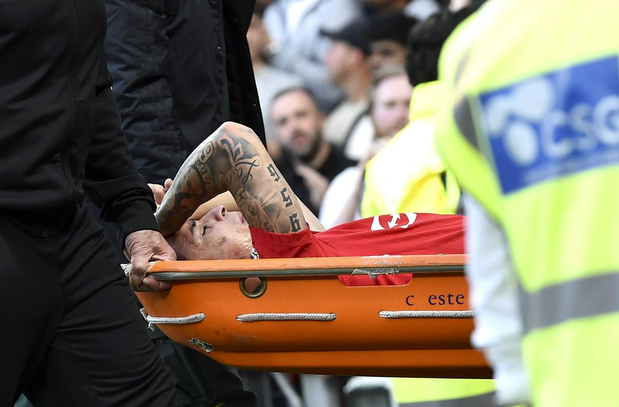 Antony left the stadium in great pain in the 29th minute.  Photo: EPA