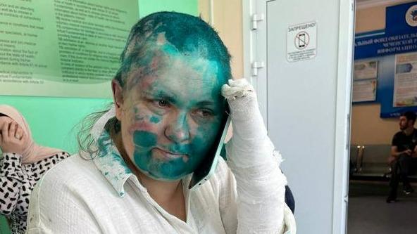 V Čečeniji brutalno pretepli rusko preiskovalno novinarko Jeleno Milašino