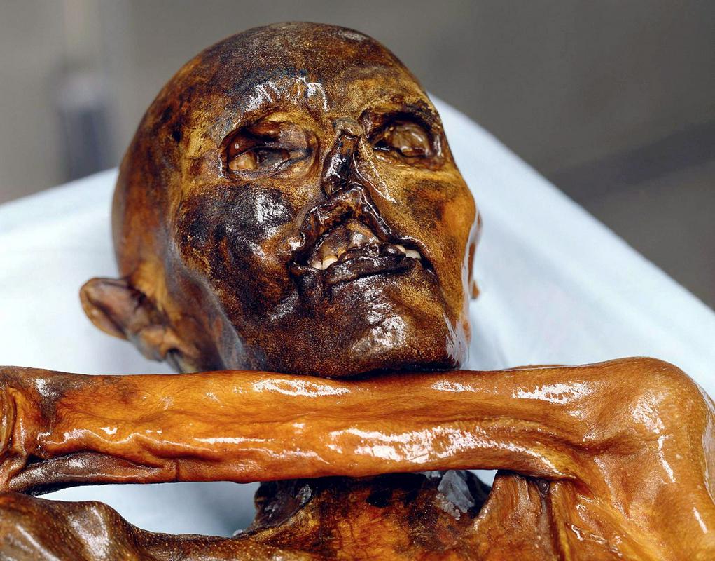 Nuova analisi del DNA di Ötzi: era più oscuro e più solido di quanto pensassimo
