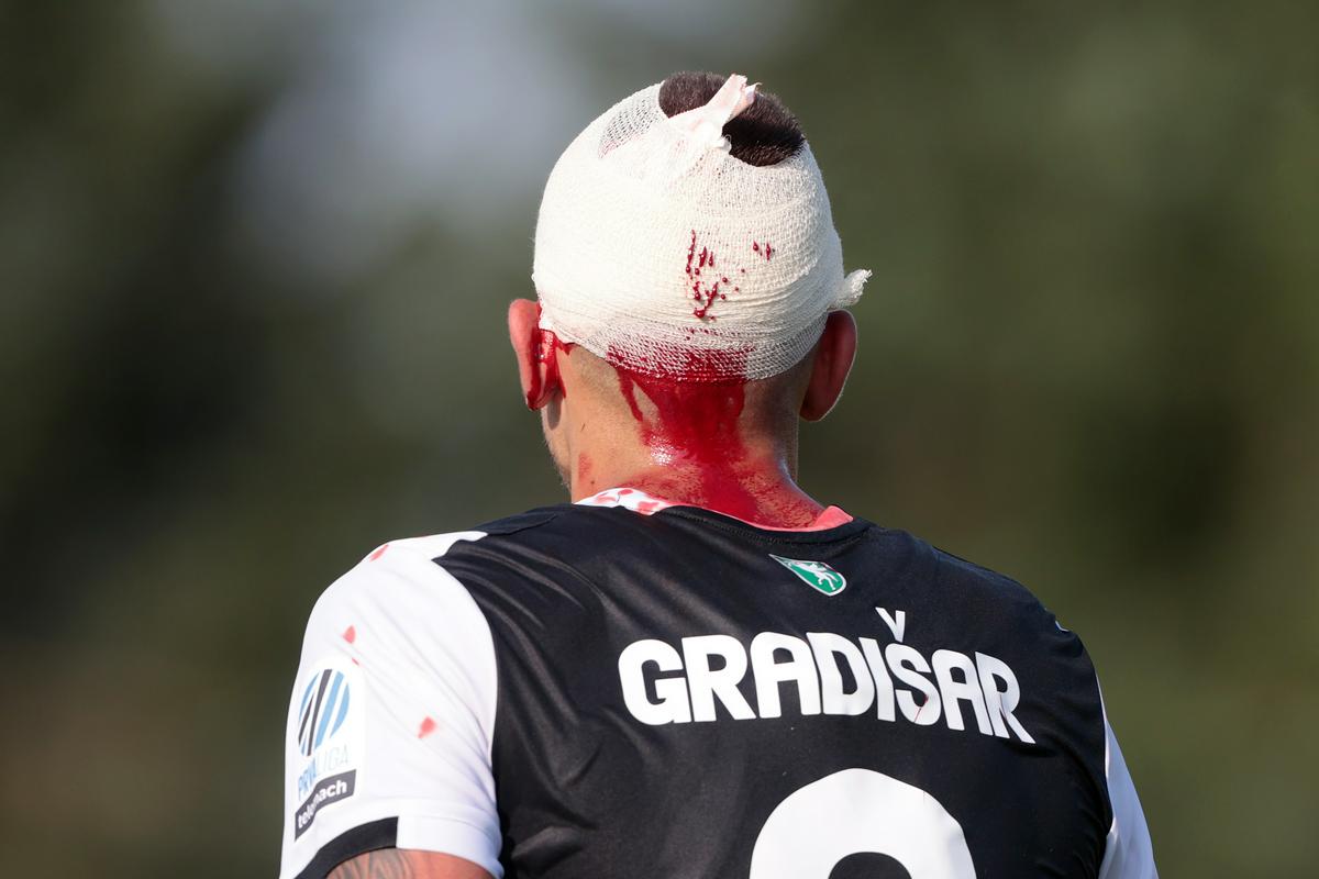Na prvem srečanju z Bravom je Nejc Gradišar staknil neugodno poškodbo glave, a zdaj je kot prvi zatresel mrežo rumenih. Foto: www.alesfevzer.com