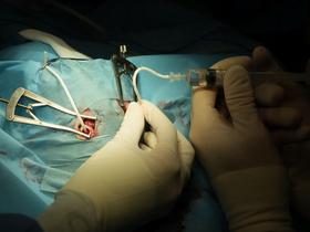  Foto: UKC Ljubljana/Osebni arhiv