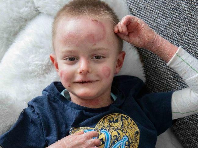 Društvo Vilijem Julijan: "Po več kot letu dni borbe dečku Milošu ZZZS odobril gensko zdravljenje"